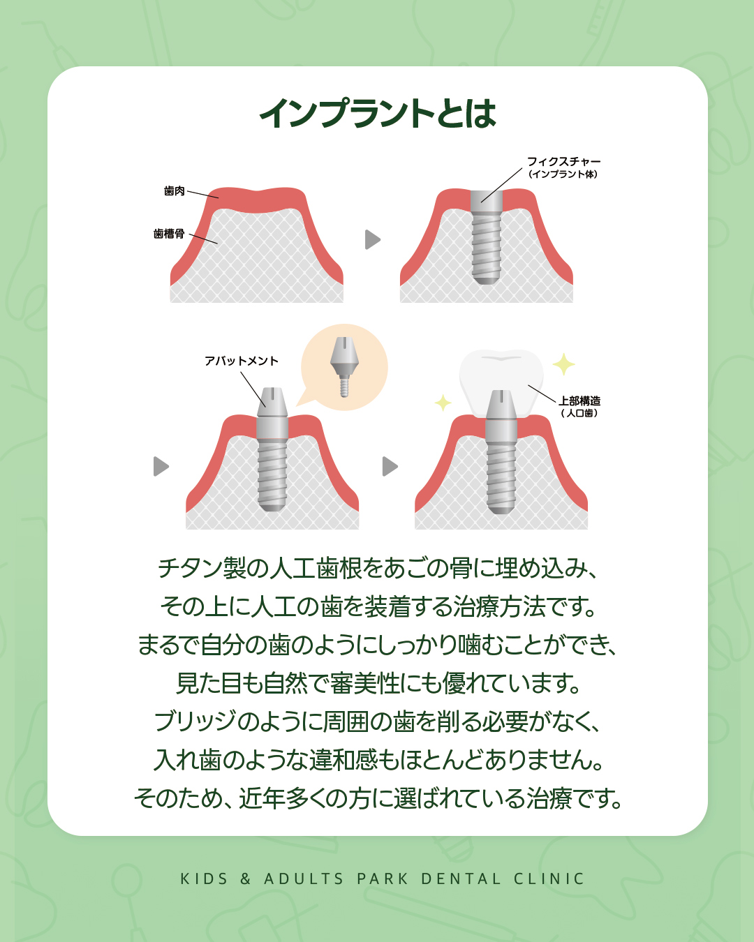 西淀川区インプラント