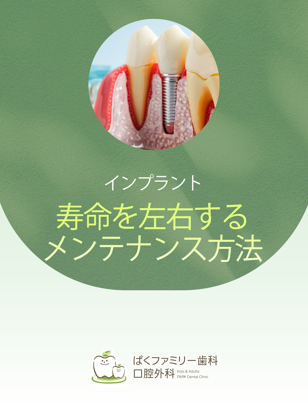 西淀川区 インプラント