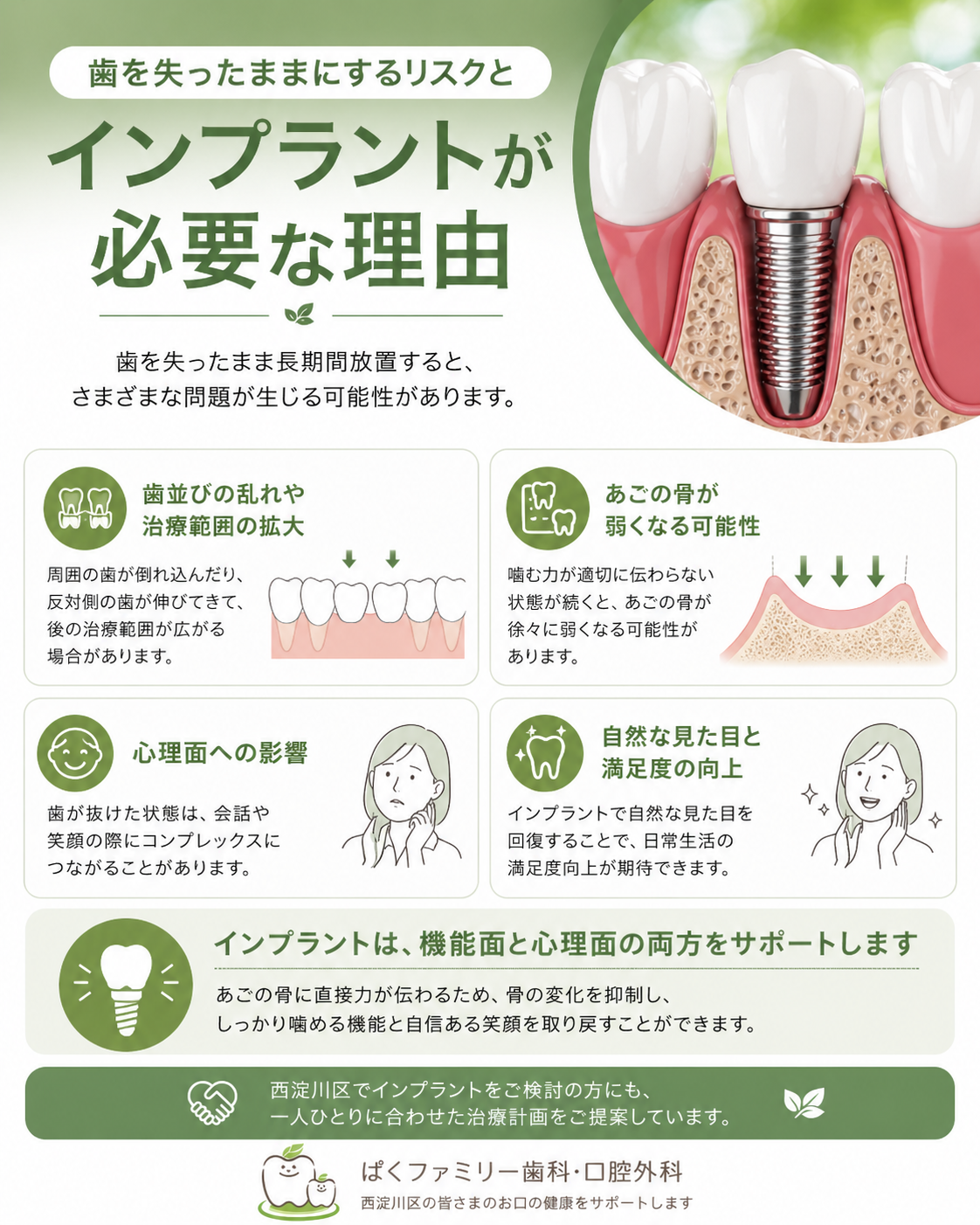 西淀川区 歯医者 インプラント治療を検討中の方へ