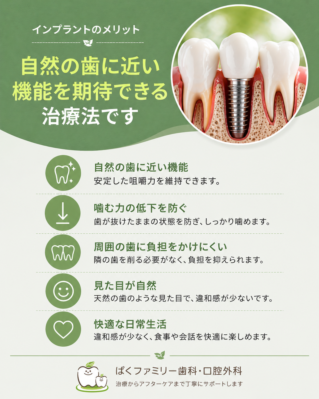 インプラントのメリット