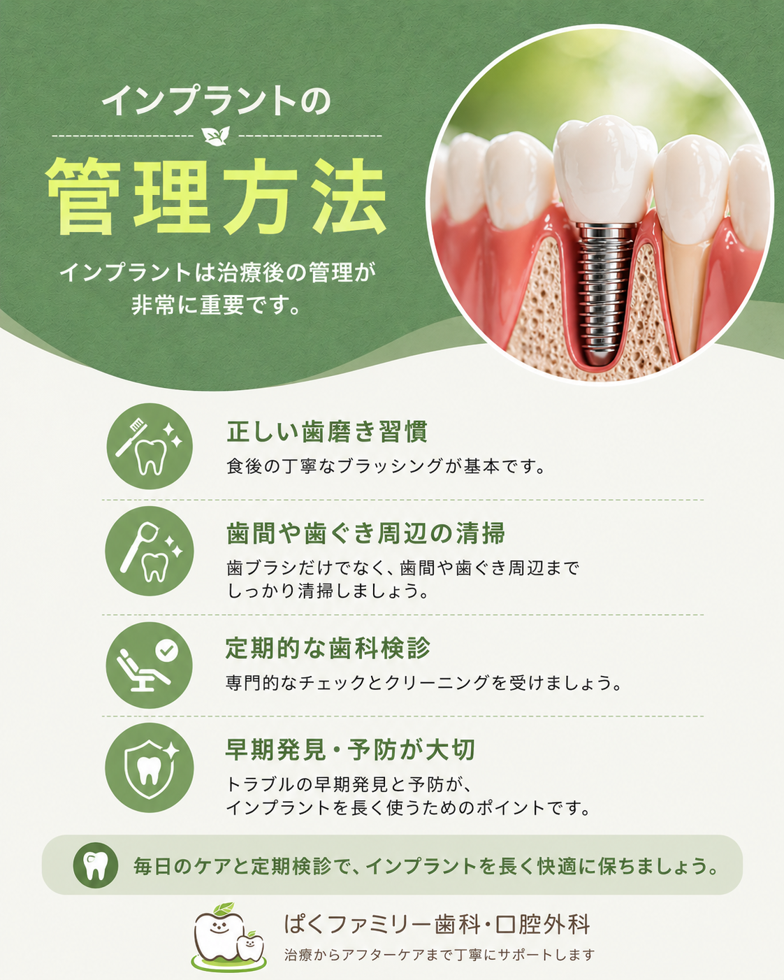 インプラント 長持ちさせるための管理方法とは