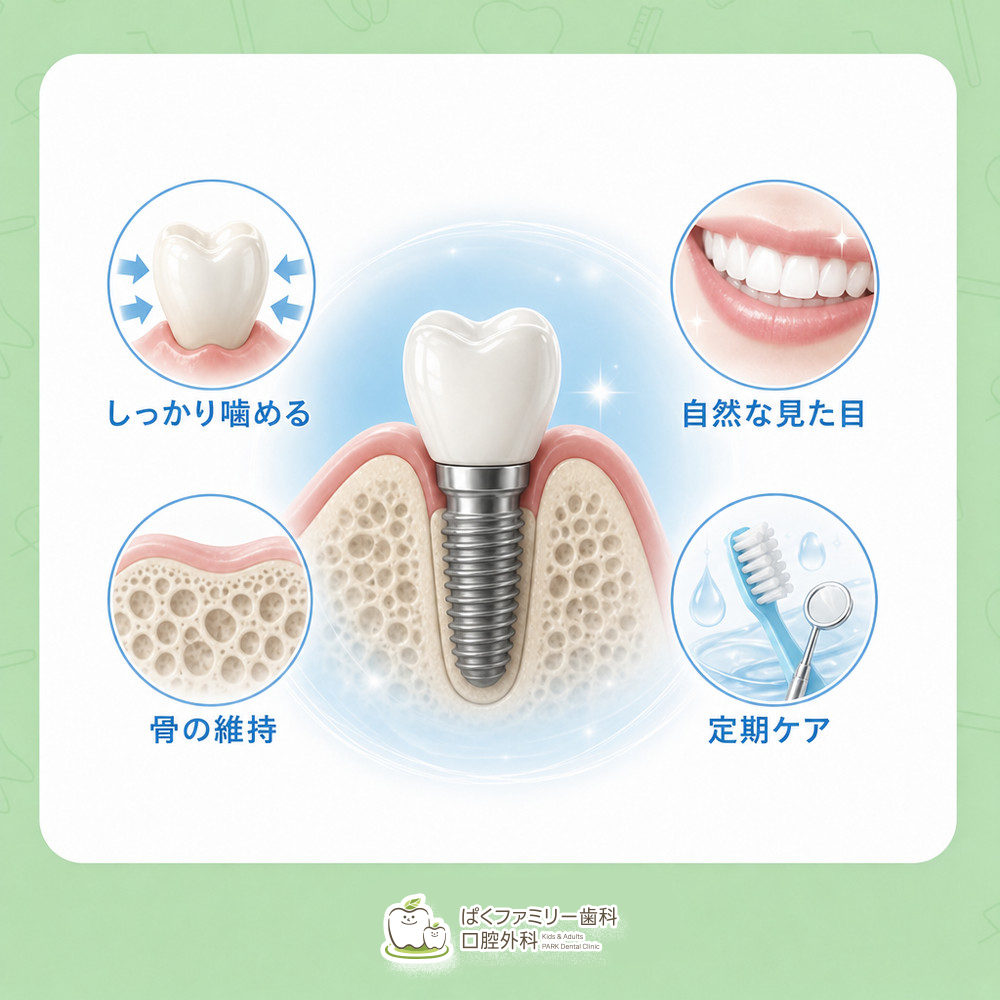 西淀川区 インプラント